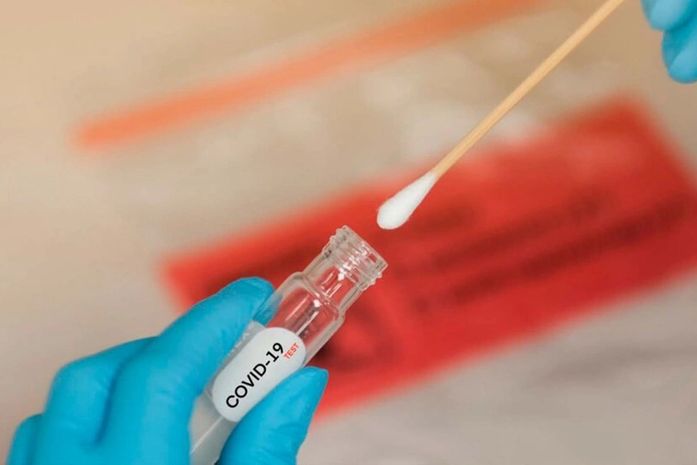 Covid-19: Alagoas confirma mais 170 casos e 16 mortes; vítimas tinham entre 31 e 85 anos