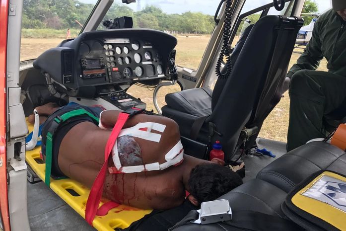 Jovem foi baleado nas costas