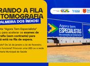 Palmeira dos Índios recebe Carreta do programa “Agora Tem Especialistas” a partir sexta (16) ; serão realizados exames de Tomografia sem contraste até 16 de fevereiro