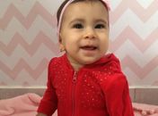 Pais cortam mão de boneca para que filha que nasceu sem mão se sinta igual a ela