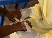Saúde confirma primeiro caso de nova cepa de mpox no Brasil
