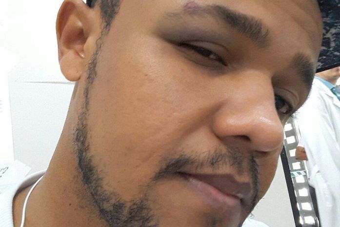 Fábio Calixto da Silva foi agredido por suposto policial