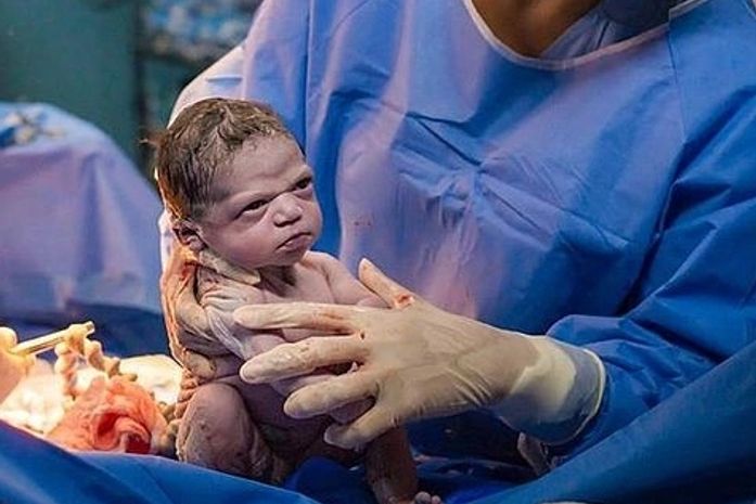 Isabela, a bebê, saiu da barriga da mãe com cara emburrada. O que foi, bebê?