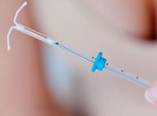 Dispositivo Interino Contraceptivo (DIU)