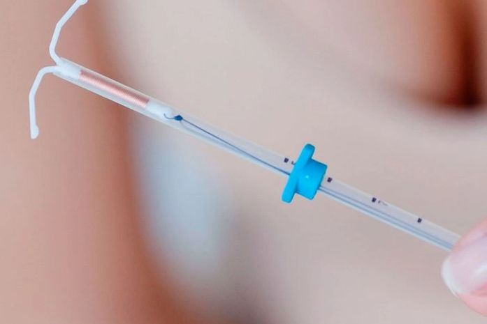 Dispositivo Interino Contraceptivo (DIU)