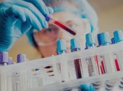 Covid-19: Alagoas registra 983 casos novos e número de infectados sobe para 18.176