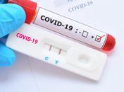 Prefeitura de Arapiraca anuncia compra de testes para diagnosticar Covid-19