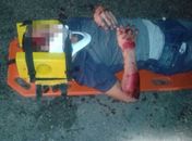Acidente provocado por animal na pista deixa adolescente gravemente ferido em Inhapi