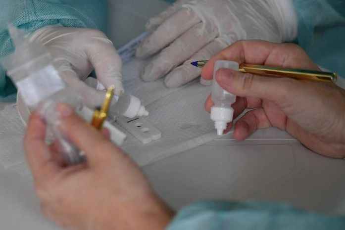 Brasil registra 21.138 novos casos e ultrapassa 173 mil mortes por Covid-19; média móvel de óbitos é de 519