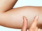 Mulheres em situação de rua terão acesso a contraceptivo inovador
