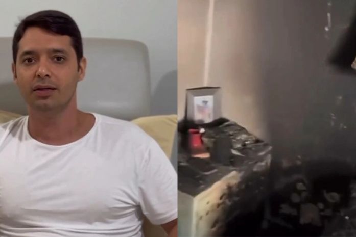 Após incêndio em casa, prefeito de cidade alagoana sofre queimadura de terceiro grau