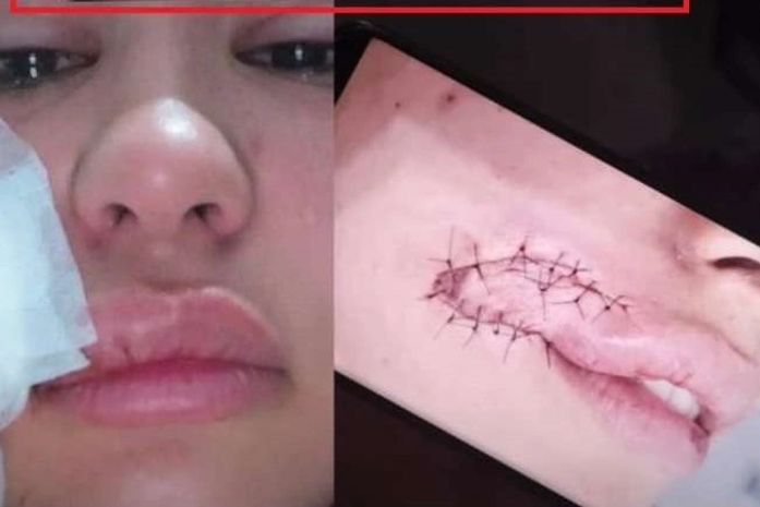 Jovem, que é do Paraguai, mostrou o rosto machucado nas redes sociais