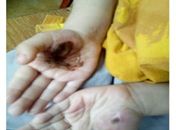 Crianças foram resgatadas pelo Conselho Tutelar e apresentavam queimaduras nos pés e nas mãos.