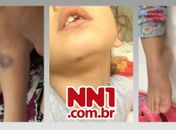 Agressão a criança dentro de creche municipal será apurada pela Prefeitura de Arapiraca