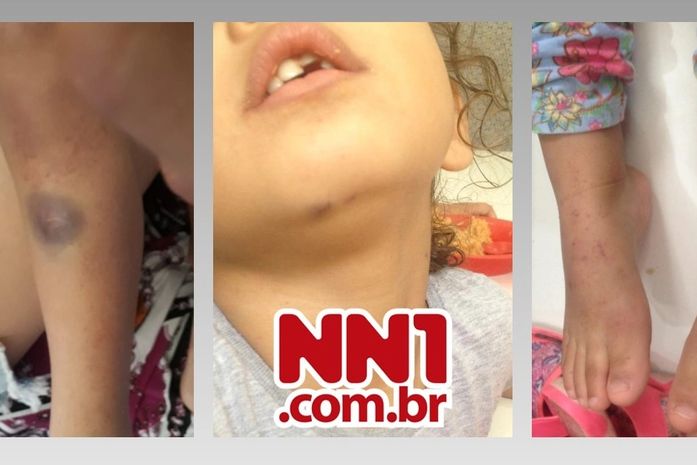 Agressão a criança dentro de creche municipal será apurada pela Prefeitura de Arapiraca