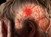 Acidente Vascular Cerebral
