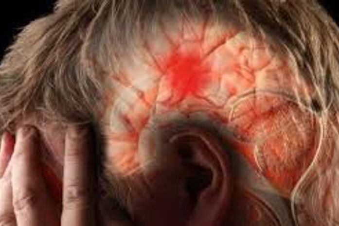 Acidente Vascular Cerebral