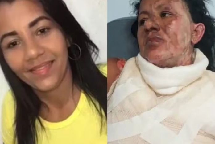 Homem suspeito de atear fogo na ex-companheira no Antares é preso pela polícia