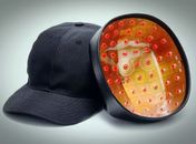 Empresa chinesa inventa boné inteligente para tratar calvície