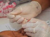 Dia de Luta contra a Aids tem ações na Pajuçara