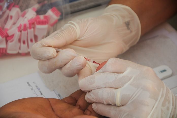 Dia de Luta contra a Aids tem ações na Pajuçara