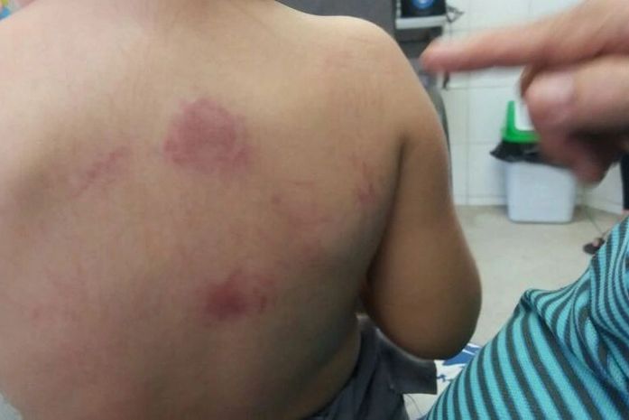 Criança foi agredida dentro de creche