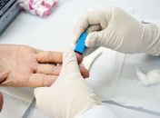 Hospital fará testes gratuitos para detectar hepatites B e C
