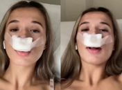 Mulher faz rinoplastia para filhos herdarem “nariz lindo” e vira meme