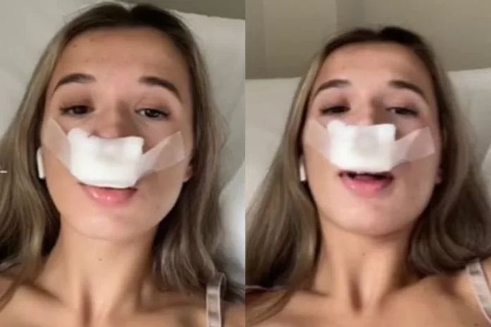 Mulher faz rinoplastia para filhos herdarem “nariz lindo” e vira meme