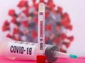 Alagoas confirma quatro óbitos e 29 novos casos de Covid em 24h; 390 pessoas estão em isolamento domiciliar
