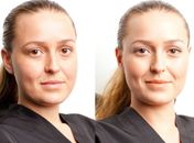 Truques de maquiagem e cuidados com a pele ajudam a disfarçar uma noite mal dormida