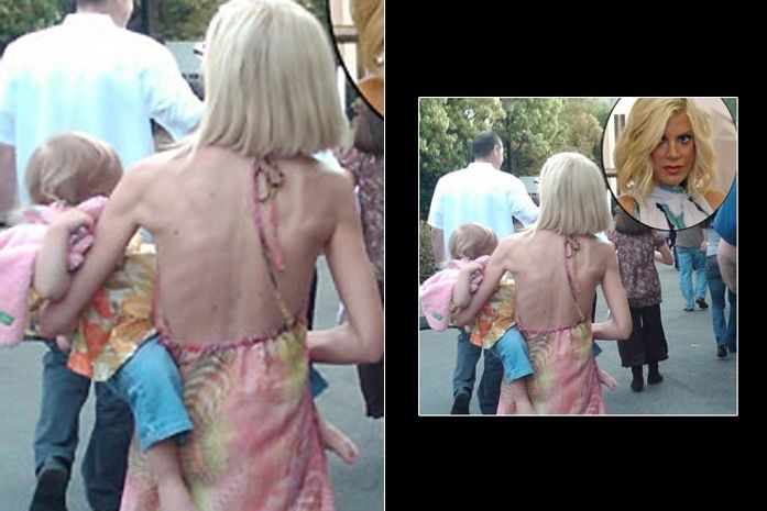 Tori Spelling aparece muito magra e levanta suspeitas de anorexia
