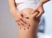 Conheça tratamentos estéticos que amenizam as estrias