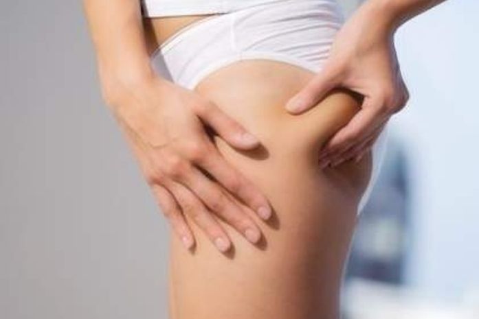 Conheça tratamentos estéticos que amenizam as estrias