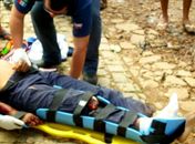 Com fraturas expostas a vítima permanece na Unidade de Emergência do Agreste em Arapiraca