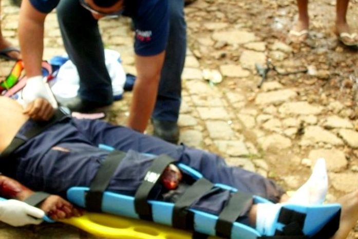 Com fraturas expostas a vítima permanece na Unidade de Emergência do Agreste em Arapiraca