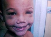 Menino espancado por padrasto morre em hospital de Volta Redonda