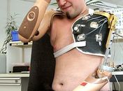 Homem que perdeu braços testa prótese controlada pela mente