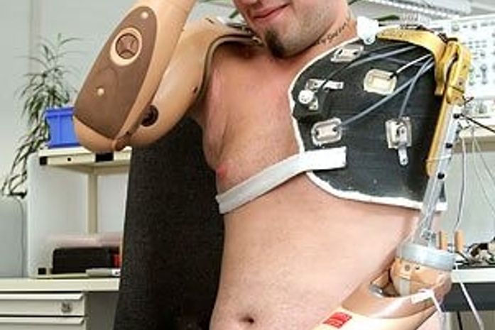 Homem que perdeu braços testa prótese controlada pela mente