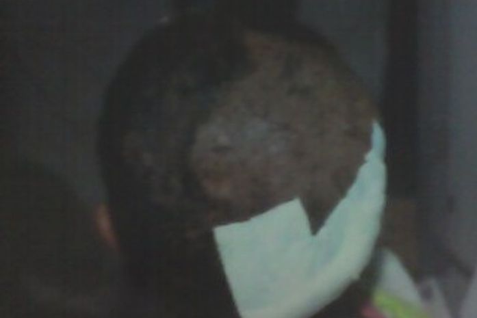 Maria Terezina, sobreviveu por pouco.