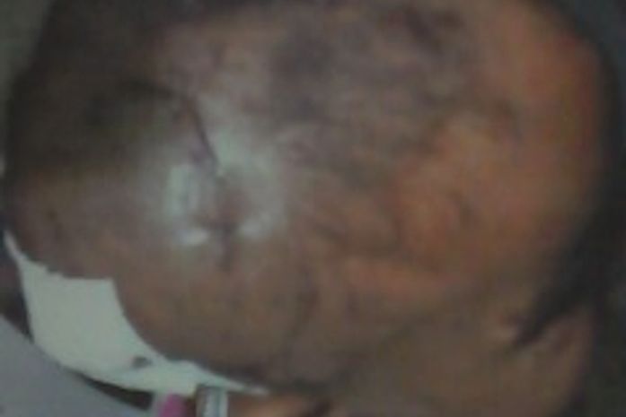 Maria Terezina, sobreviveu por pouco.