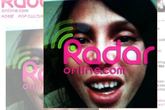 Divulgada foto do rosto da ex de Mel Gibson após agressão