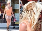 

Britney e as falhas: problema chama-se alopecia de tração e  pode deixar a cantora calva
