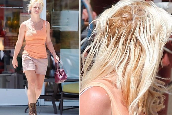 Britney e as falhas: problema chama-se alopecia de tração e pode deixar a cantora calva