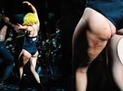 Lady Gaga exibe celulites na coxa durante show