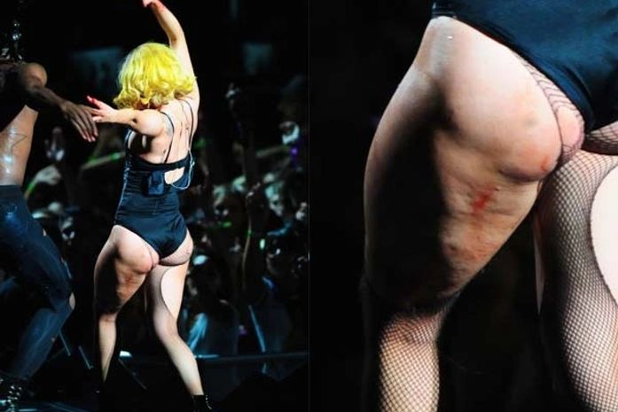 Lady Gaga exibe celulites na coxa durante show