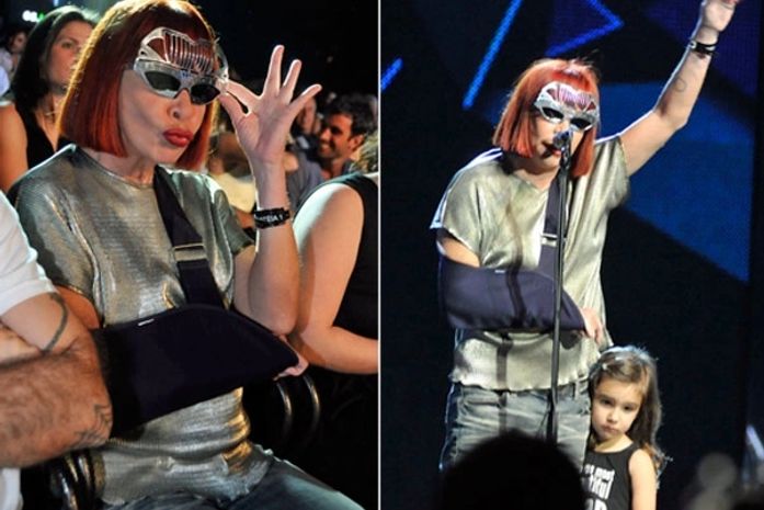 Depois de botox, Rita Lee faz plástica, conta jornal