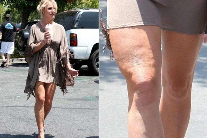 Britney Spears exibe pernas ‘metralhadas’ nos Estados Unidos