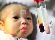 Bebê com sangue cor-de-rosa surpreende médicos na China