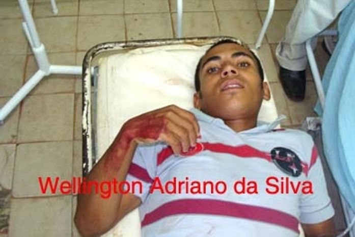 Assaltante é baleado após cometer assalto em São José da Lage